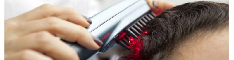 Laserová vlasová terapie