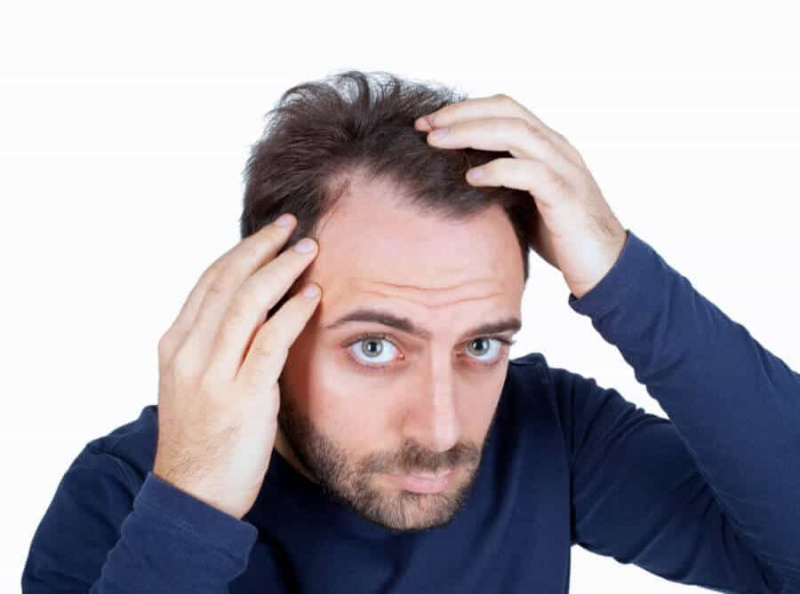 Drogerový šampon může zvýšit vypadávání vlasů, kterého se většina mužů obává