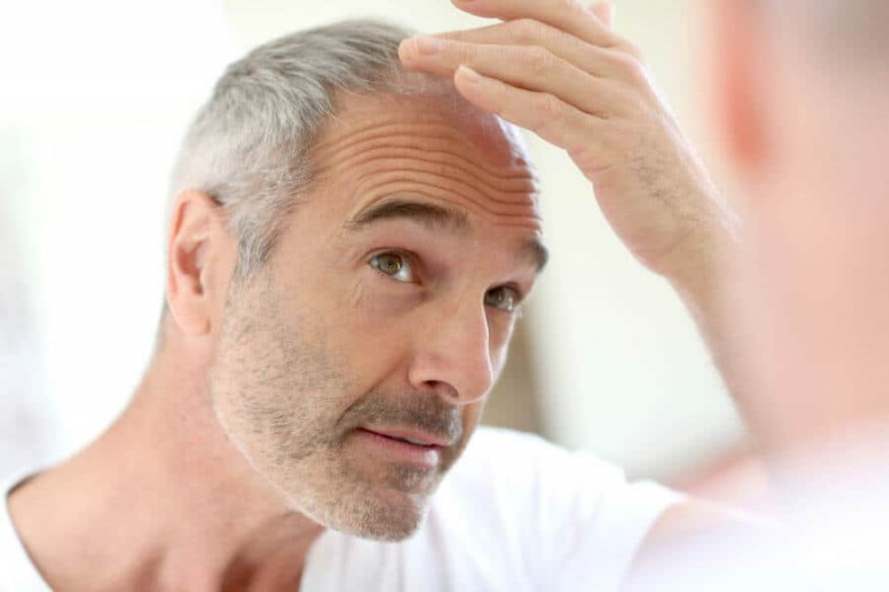 Les problèmes de perte de cheveux peuvent être la principale préoccupation