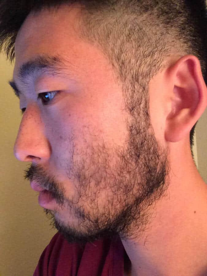 Un problème courant pour les hommes qui se font pousser la barbe