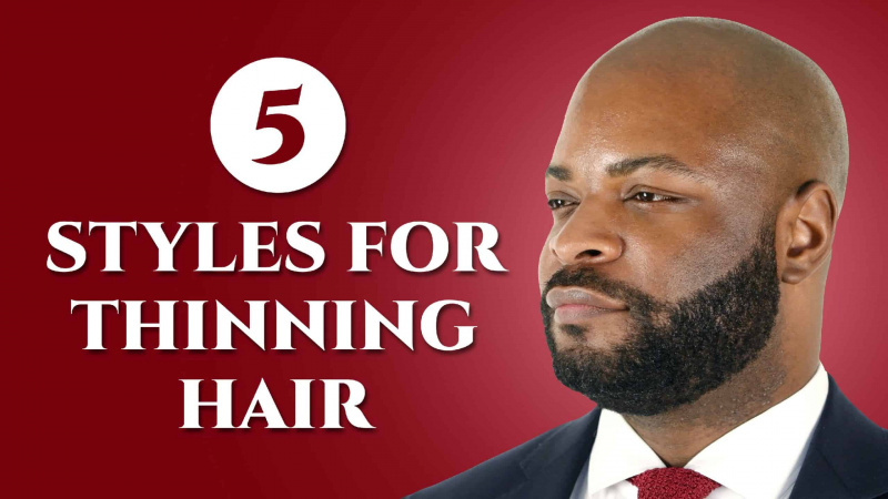 Ovatko hiuksesi ohenemassa? Kokeile näitä 5 klassista miesten hiustyyliä!